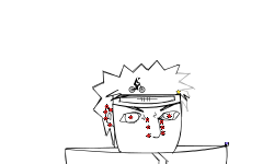 Pain