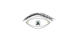 A bad eye