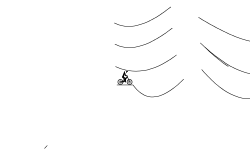 Climb the Skeloton