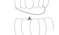wacky track