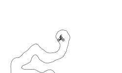 Intestines I