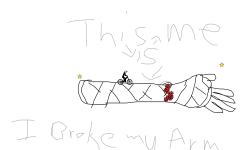 i broke my arm :(