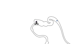 Blob Dash!