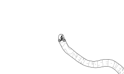 Enclosed Endo (Prev.)